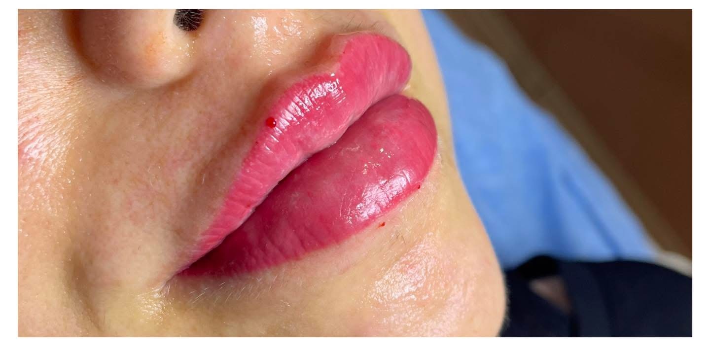 Utána